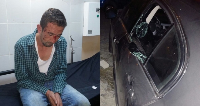 KUŞADASI'NDA ŞÜPHELİ KAÇTI 4 POLİS YARALI