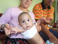 Emrecan bebek doğuştan kadersiz