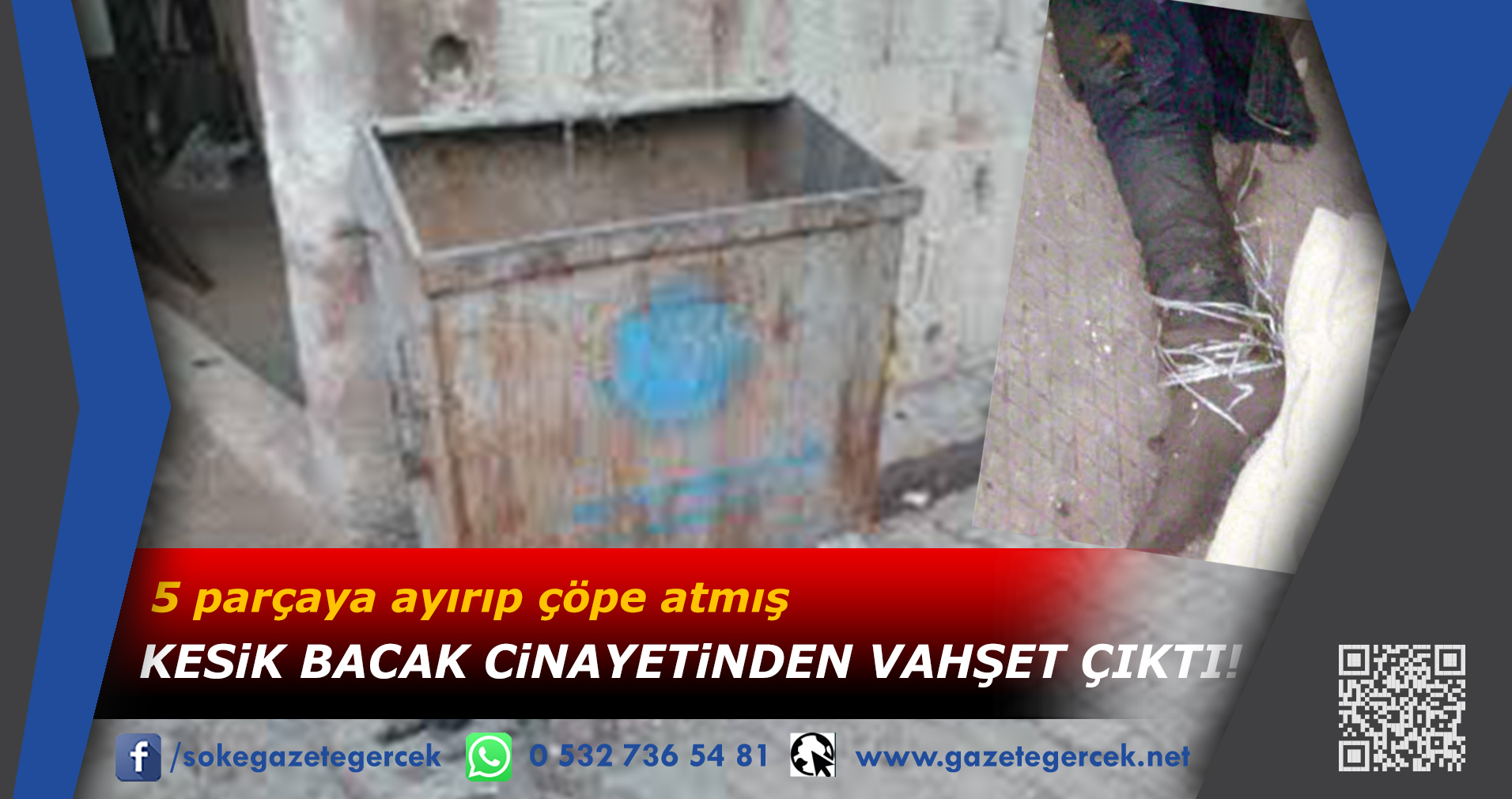 5 parçaya ayırıp çöpe atmış KESiK BACAK CiNAYETiNDEN VAHŞET ÇIKTI!