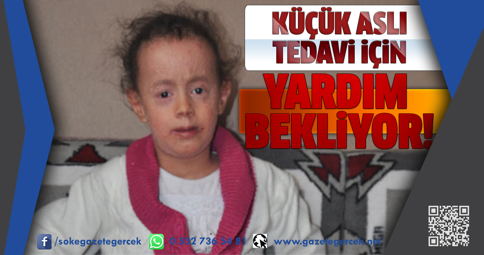 KÜÇÜK ASLI TEDAVi iÇiN YARDIM BEKLiYOR!