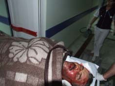 Sanayi kavşağında yine kaza